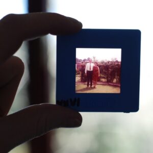 Sind Karies und Parodontose erblich